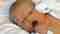 ¿Qué es la Hiperbilirrubinemia en el recién nacido? – Bienestar y Salud