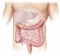 Cáncer de colon – Bienestar y Salud – WebMediums